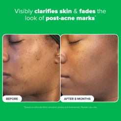 10% Azelaic Acid Booster 30ML