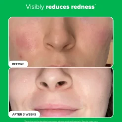 10% Azelaic Acid Booster 30ML