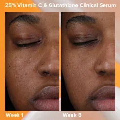 25% Vitamin C + Glutathione Clinical Serum 30ML