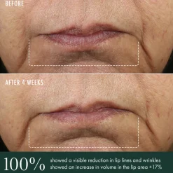 Advanced Lip Perioral Serum 15ML
