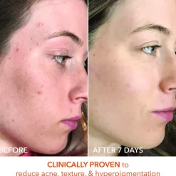 Alpha Beta Universal Daily Peel