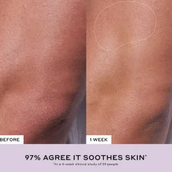 Après Skin Multi-Use Rich Rescue Crème 75ML