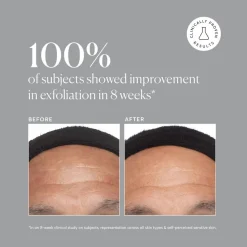 Azelaic Acid 10% 30ML