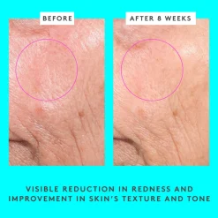 Bouncy Brightfacial™ 50ML