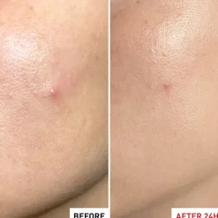 Centella Sos Patch 15ML