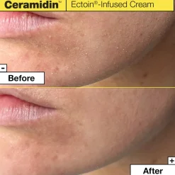 Ceramidin Infused Ectoin Cream 50ML