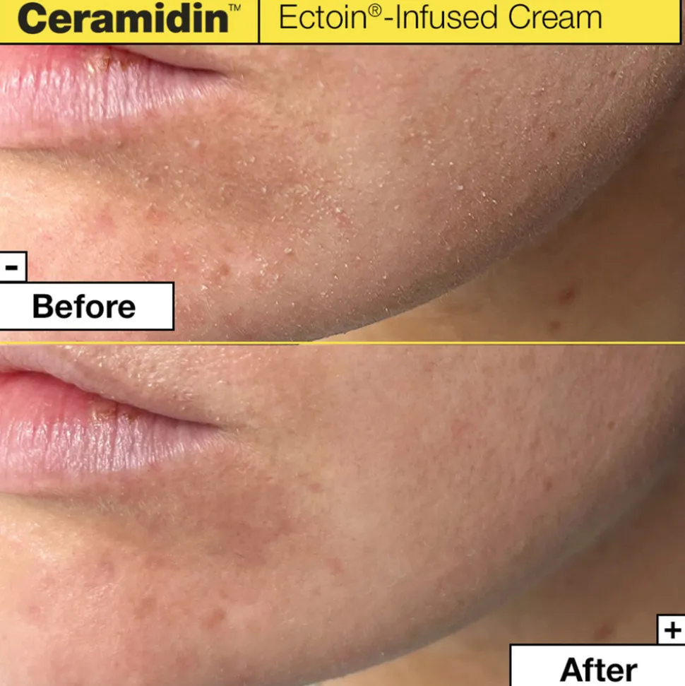 Ceramidin Infused Ectoin Cream 50ML