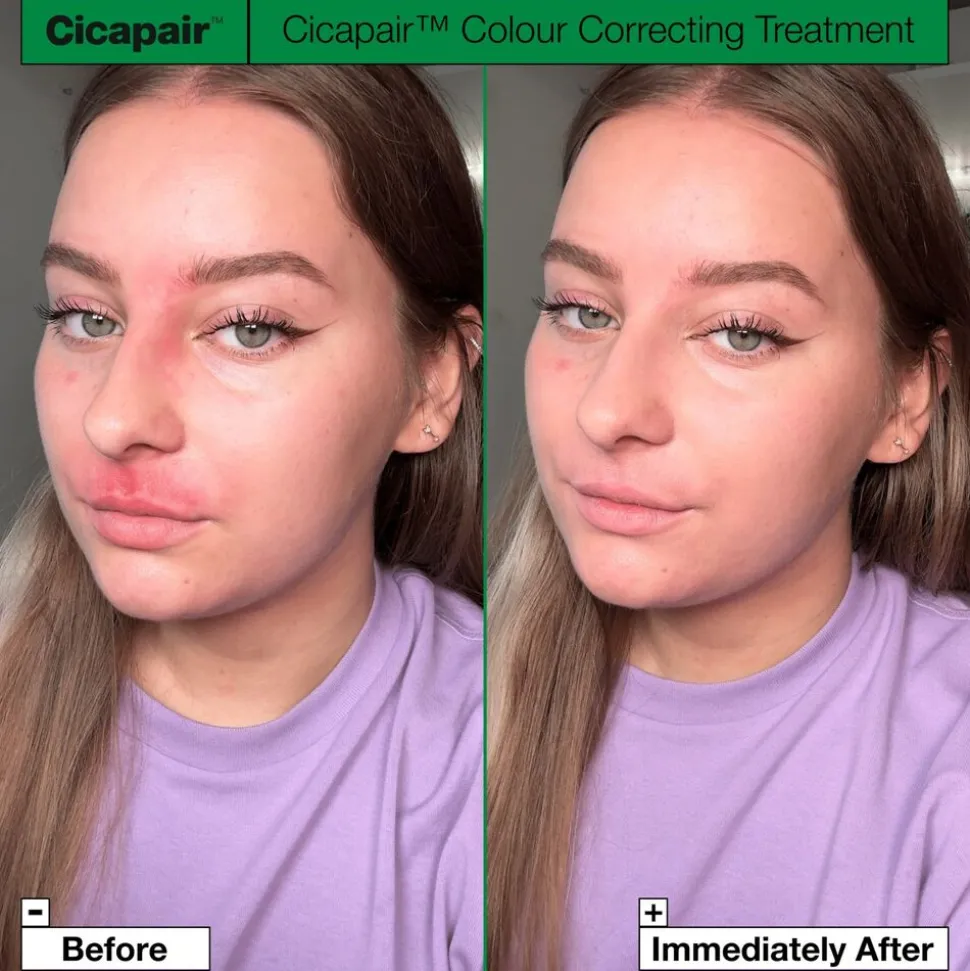Cicapair Tiger Grass Color Correcting Treatment