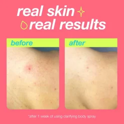 Clarifying Body Spray 177ML