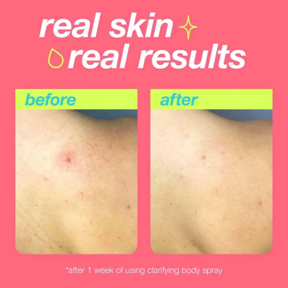 Clarifying Body Spray 177ML