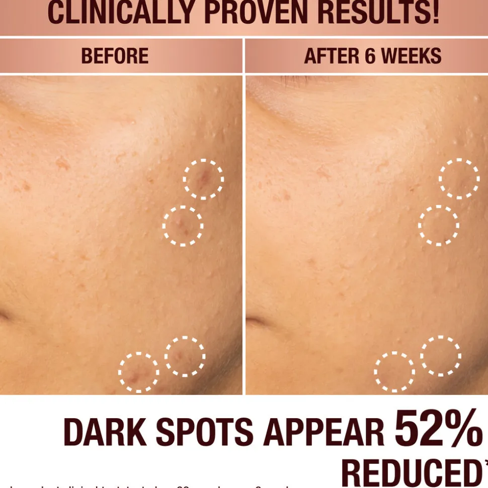 Dark Spot Correcting Radiance Recovery Serum