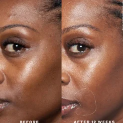 Double Rewind 0.3% Pro-Grade Retinol Serum 30ML
