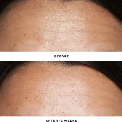 Double Rewind 0.3% Pro-Grade Retinol Serum 30ML