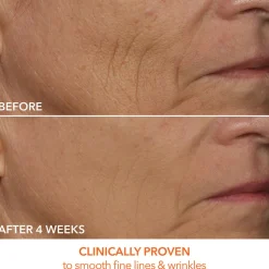 DRx SpectraLite FaceWare Pro