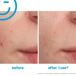 EradiKate Blemish Spot Treatment 30ML