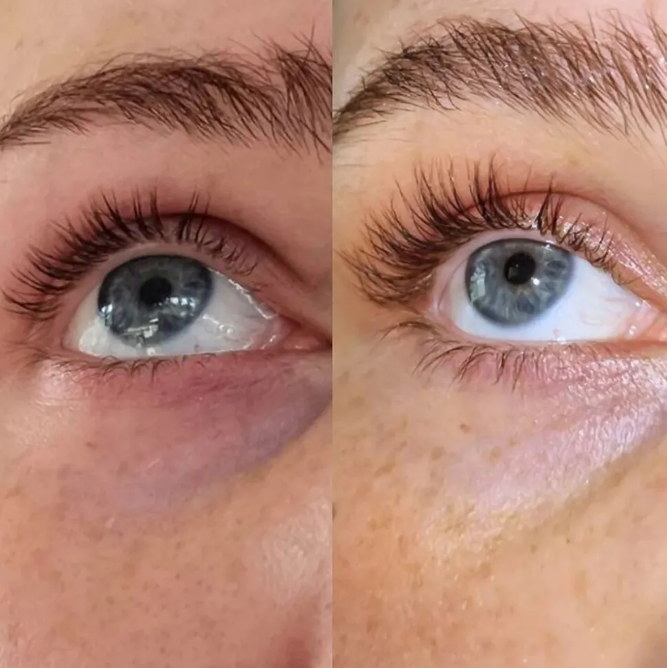 Eyelash Growth Serum