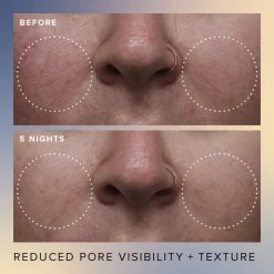 Honey Glow 17% Resurfacing Acid Serum 30ML