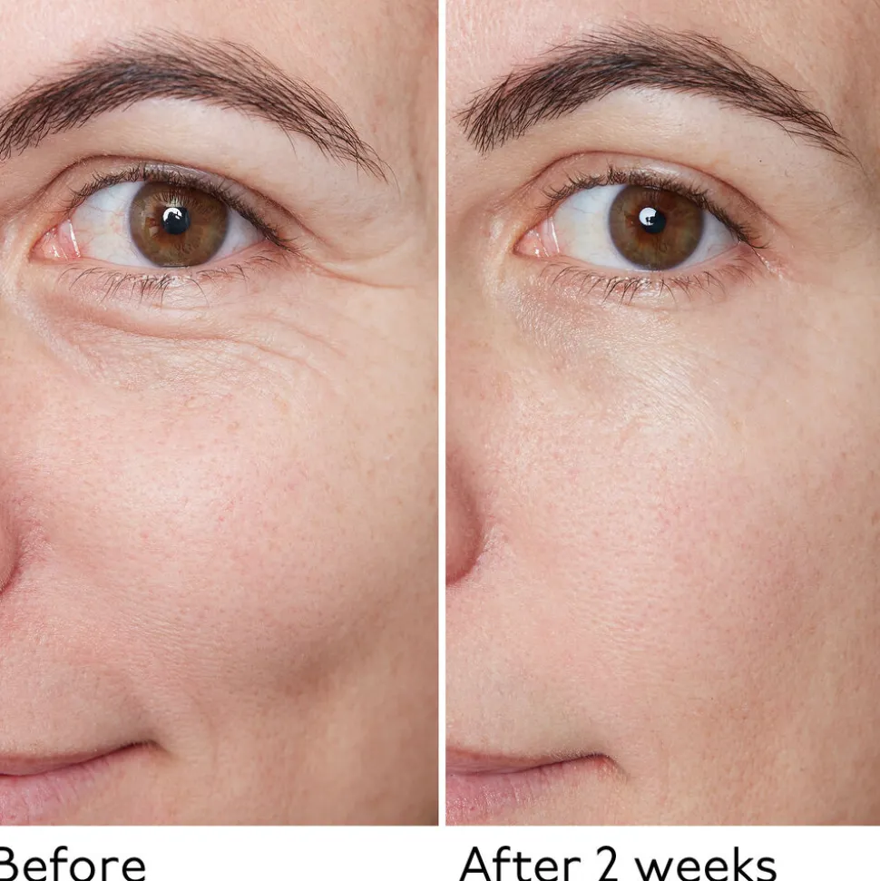 Hyaluronic Global Serum