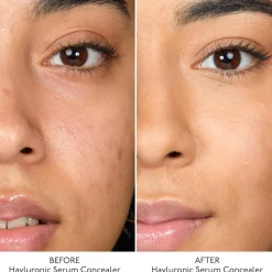 Hyaluronic Serum Concealer