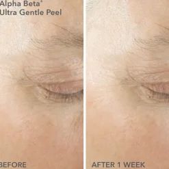 Limited Edition Spring Kit: Alpha Beta® Smooth, Radiant, Firm For Sensitive/Normal Skin