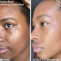 Limited Edition Spring Kit: Alpha Beta® Smooth, Radiant, Firm For Sensitive/Normal Skin