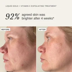 Liquid Gold + Vitamin C 100ML