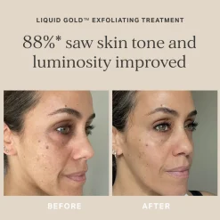 Liquid Gold with 5% Glycolic Acid 100ML
