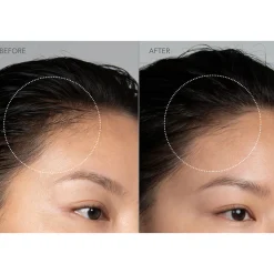 Luna™ 4 Hair