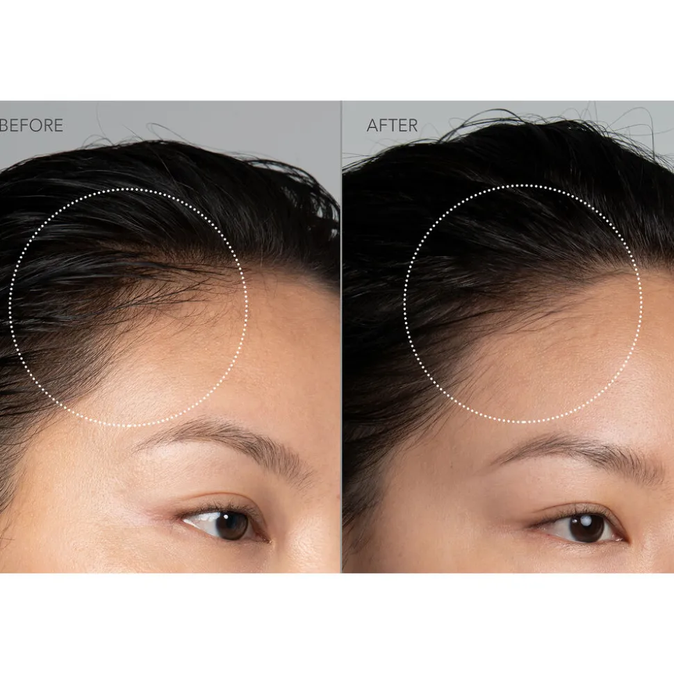 Luna™ 4 Hair