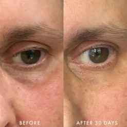 Niacinamide & Caffeine Eye Bright Cream 15G