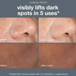 PowerBright Dark Spot Peel 50ML