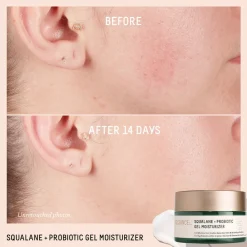 Probiotic Gel Moisturizer 50ML