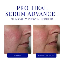 Pro-Heal Serum Advance+ 15ML