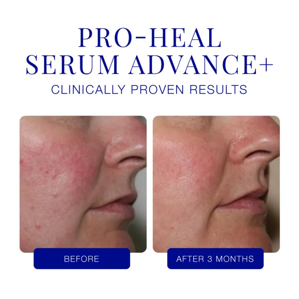 Pro-Heal Serum Advance+ 15ML