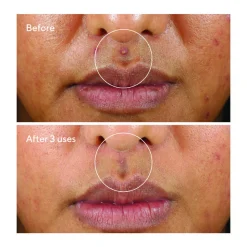 Rapid Relief Sulfur Mask 74ML