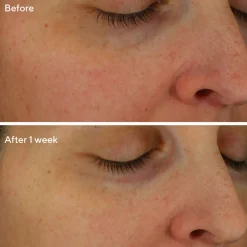 Restorative Hydro-Hyaluronic Cream 50ML