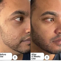 Retinal + Niacinamide Youth Serum 30ML