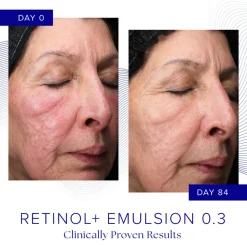 Retinol + Emulsion 0.3 30G