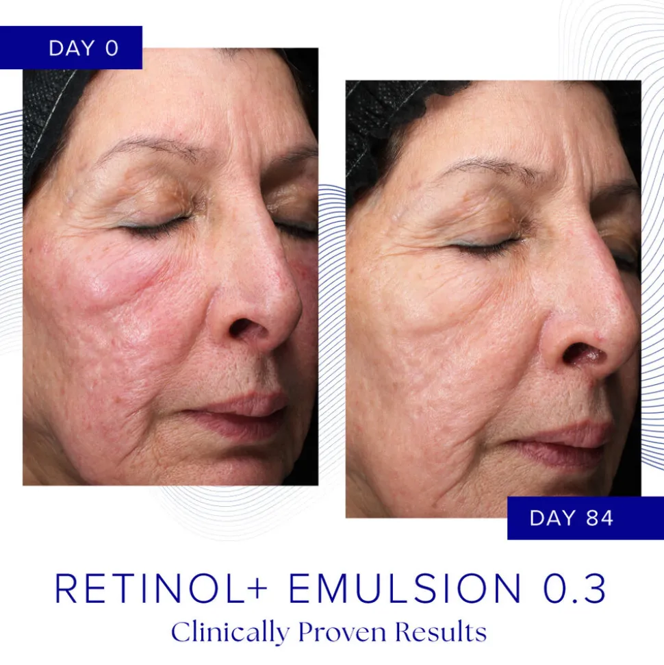 Retinol + Emulsion 0.3 30G