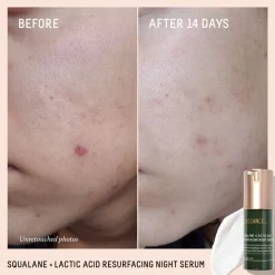 Squalane + Lactic Acid Resurfacing Night Serum 30ML