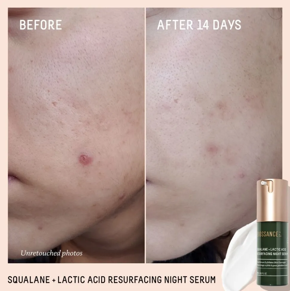 Squalane + Lactic Acid Resurfacing Night Serum 30ML