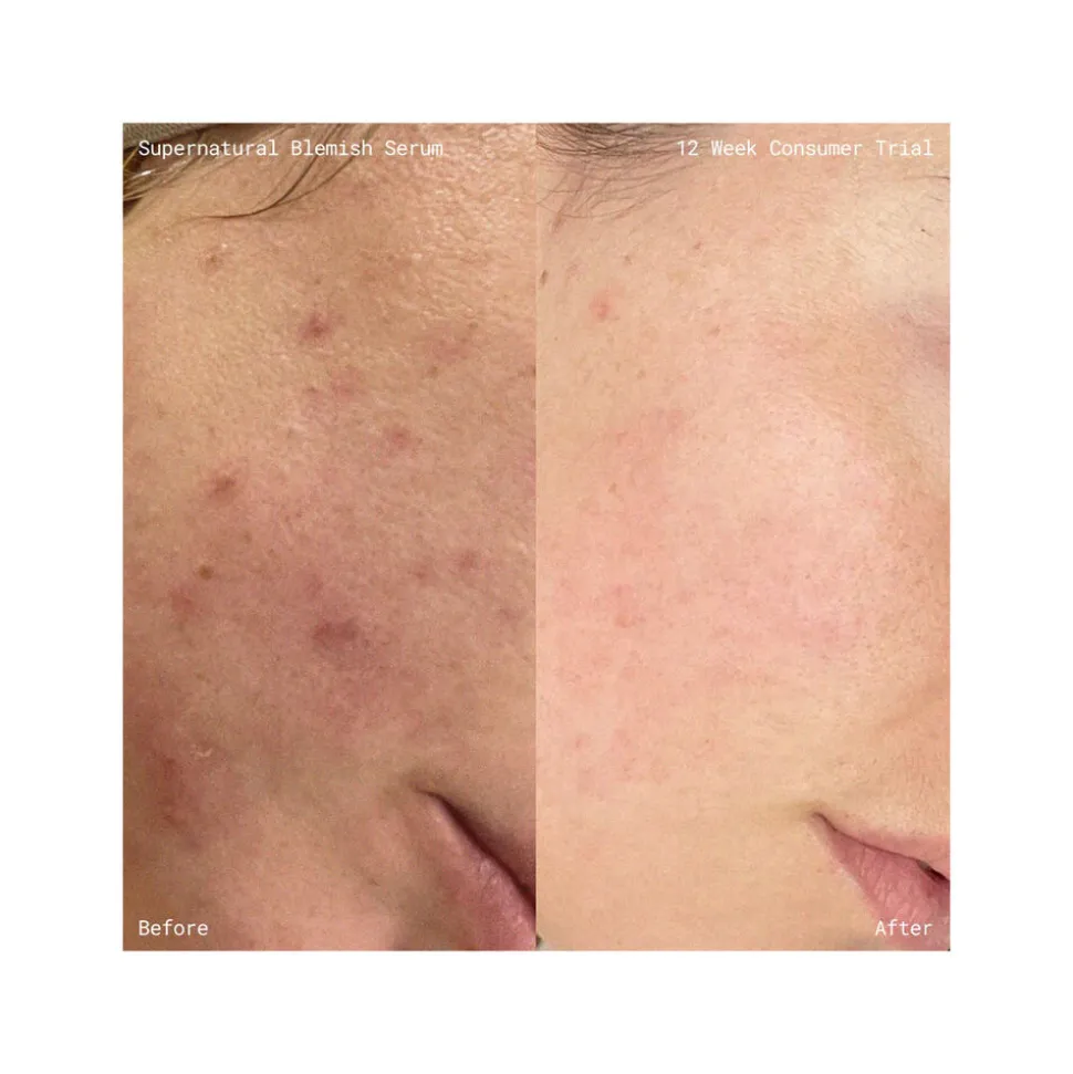 Supernatural Blemish Face Serum Refill 60ML