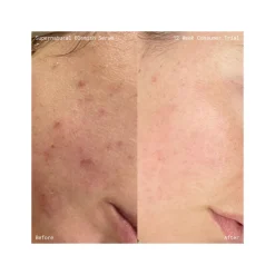Supernatural Blemish Face Serum 60ML