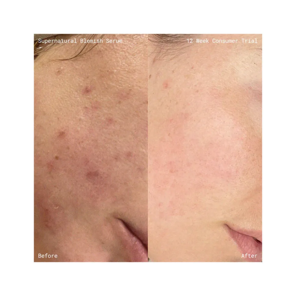 Supernatural Blemish Face Serum 60ML