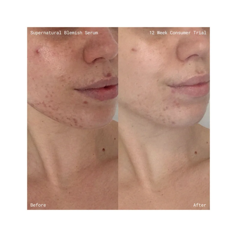 Supernatural Blemish Face Serum 60ML