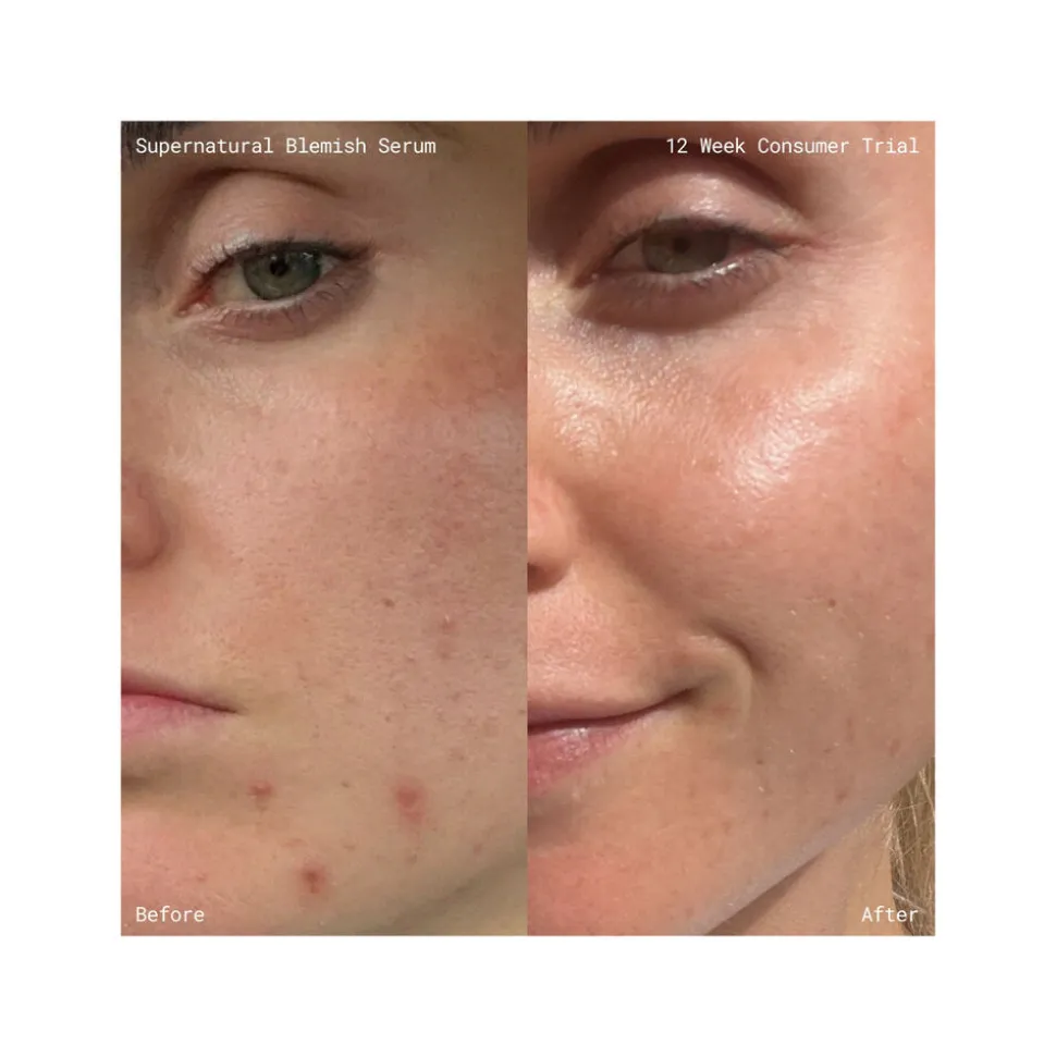 Supernatural Blemish Face Serum 60ML