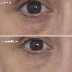Targeted Eye Depuffer 15ML