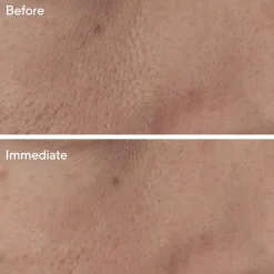 Targeted Pore Corrector 15ML