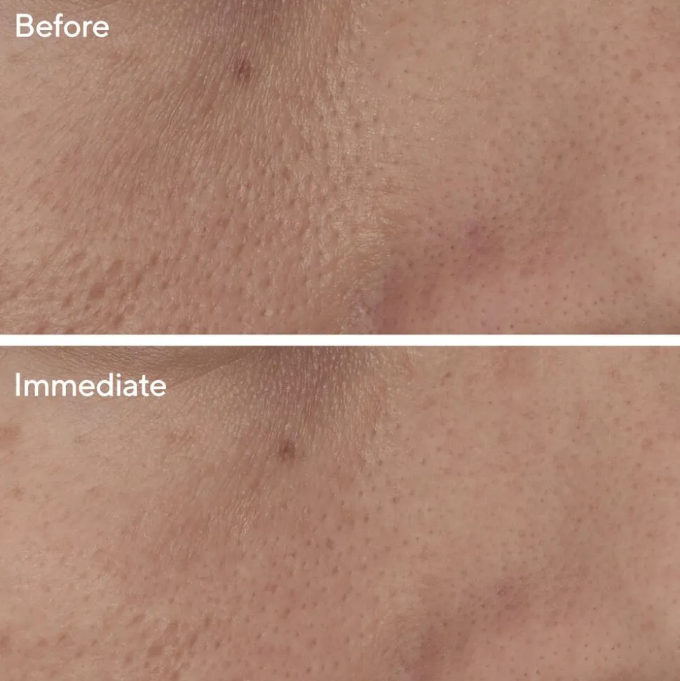 Targeted Pore Corrector 15ML