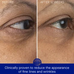 The Eye Cream